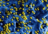Ondernemers getroffen sectoren coronavirus kunnen tegemoetkoming aanvragen
